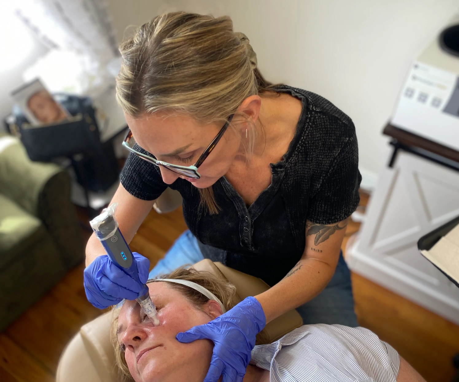 SkinPen® Microneedling with PRP beauty marks aesthetics 1